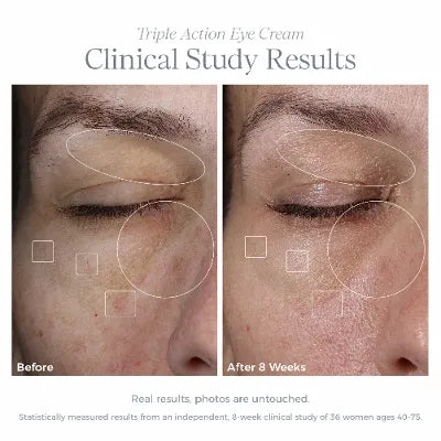 Celavive Triple Action Eye Cream: Anti-aging