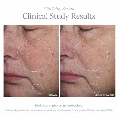 Celavive Vitalizing Serum: Hydrating Formula